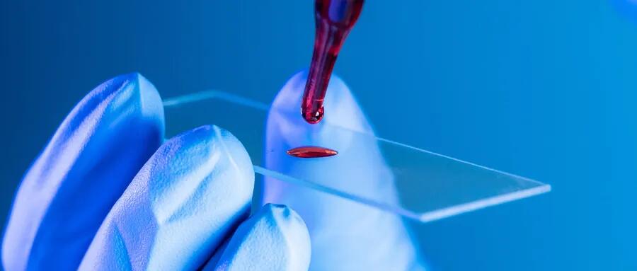 【原創研究】血液制品行業投研報告之二：國內企業分離提純工藝仍有較大提升空間